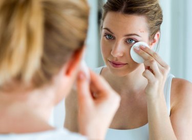 Woman with acne-prone skin cleaning her face Woman with acne-prone skin cleaning her face